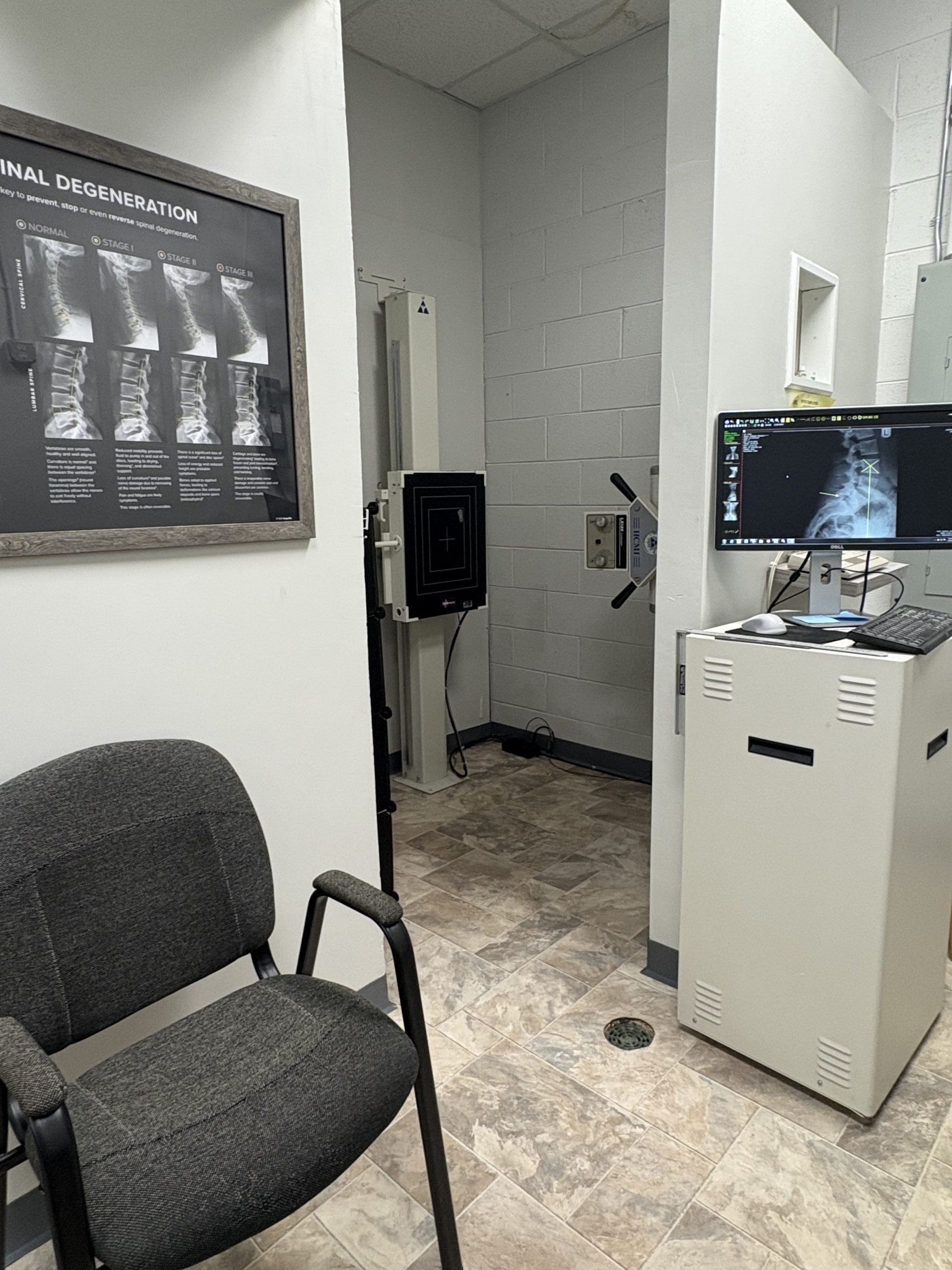 X-Rays